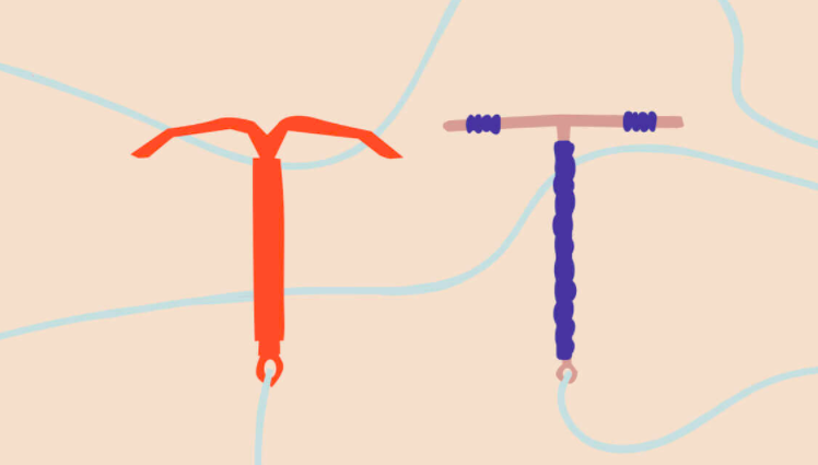 how much is an iud without insurance