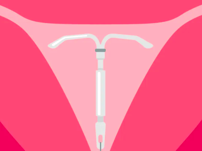 how much is an iud without insurance
