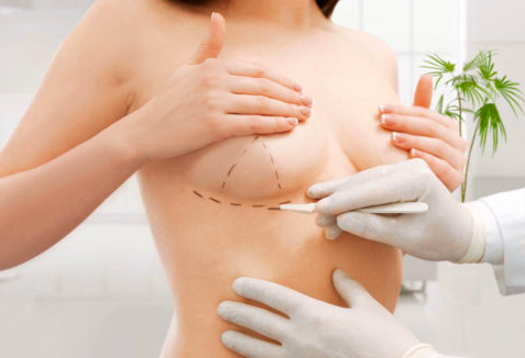 how to get a breast reduction covered by insurance
