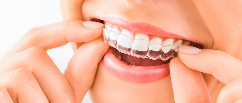 how much is invisalign without insurance