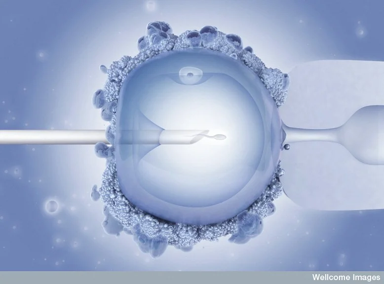 does insurance cover ivf