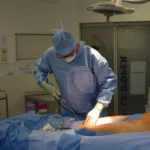 can insurance cover liposuction